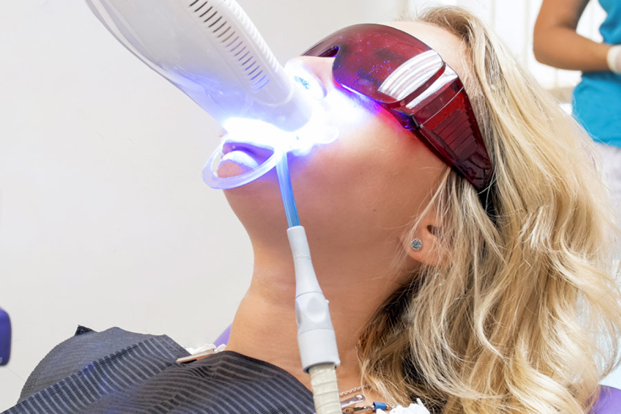 Clareamento dental a laser