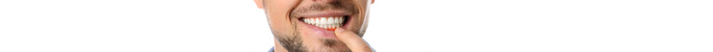 Periodontista em Brasília